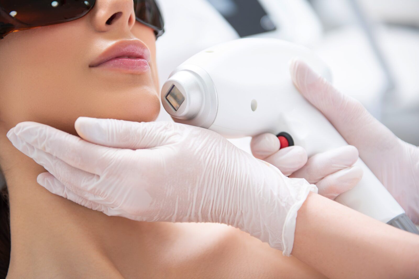 Laser Treatments For Skin